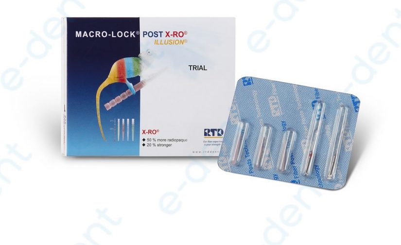 Trial Kit Macro Lock Rtd